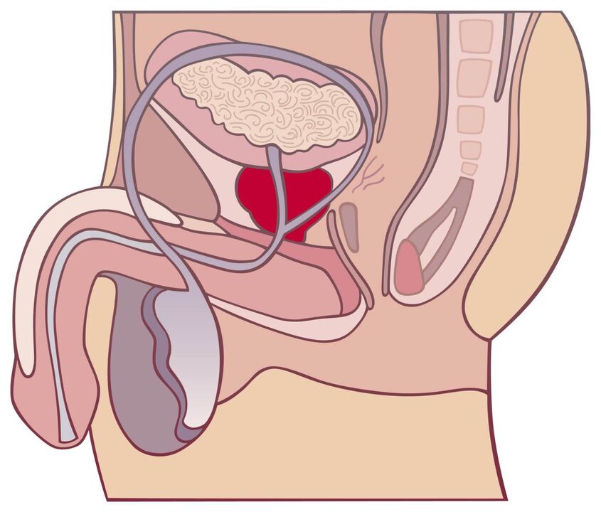 All about prostatitis