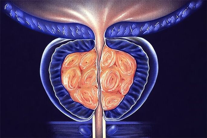 prostate inflammation in men