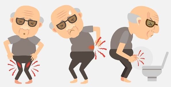 symptoms of prostatitis and its treatment with medications